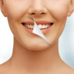 Experience Teeth Whitening Procedures and Reliable Recovery Care through Dental Services in Winnipeg